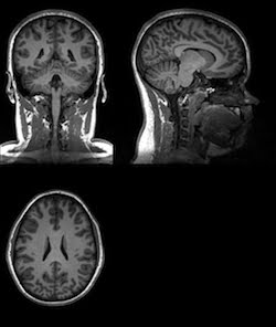 Les neuromythes constituent un obstacle au changement dans le domaine de l’éducation