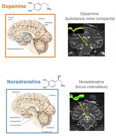 andre-perret-je-suis-en-guerre-contre-la-dictature-de-qualiopi-management-de-la-formation